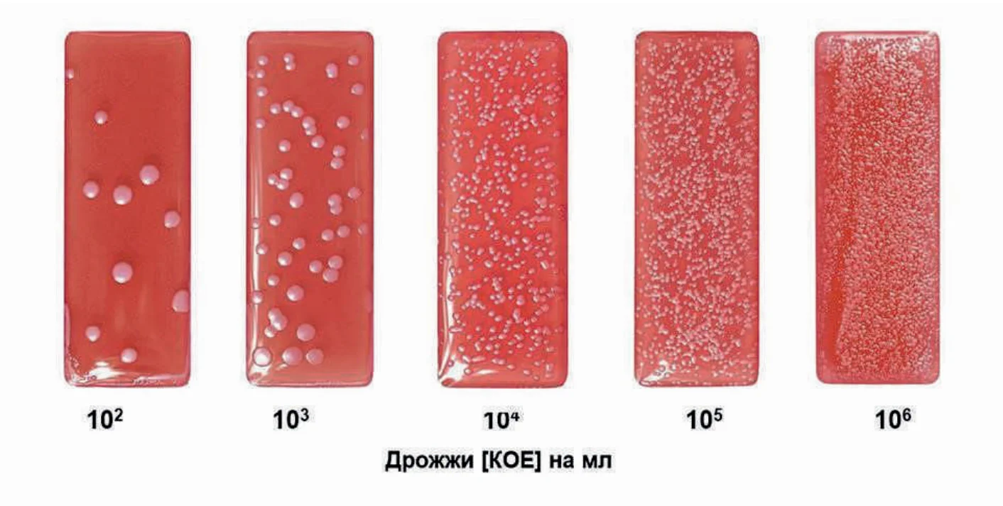Экспресс-тест Дип слайд DipSlide Грибы/Грибы, «ЭкспертЦентр» Экспресс-тест Дип слайд DipSlide Грибы/Грибы, фото №38